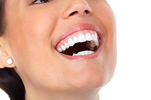 Blanqueador Dental Carbón Activado - IDEA NATURAL - 100% NATURAL - No OGM, Mejor que las tiras, Pasta de Dientes. Elimina las manchas y la placa (20g)