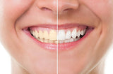 Blanqueador Dental Carbón Activado - IDEA NATURAL - 100% NATURAL - No OGM, Mejor que las tiras, Pasta de Dientes. Elimina las manchas y la placa (20g)