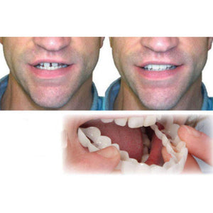 Edtara Cubierta de Dientes Perfect Smile Comfort Fit Dientes Flexibles, Carillas Dientes Superiores + Juego de Dientes Inferiores