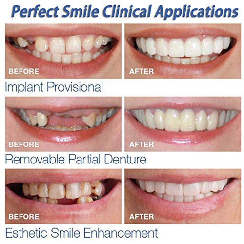 Hennta 5PC Temporal Smile Comfort Fit Cosméticos Dientes Dientes Dentales Top Chapa cosmética