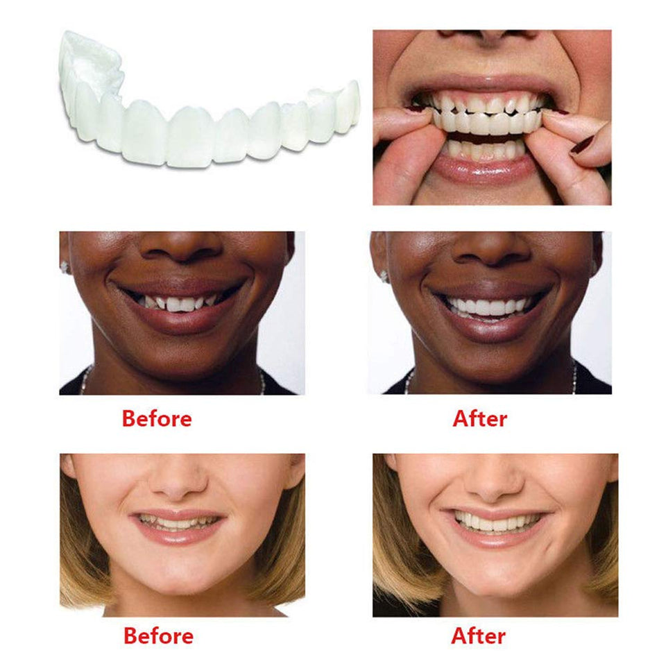 Edtara Cubierta de Dientes Perfect Smile Comfort Fit Dientes Flexibles, Carillas Dientes Superiores + Juego de Dientes Inferiores