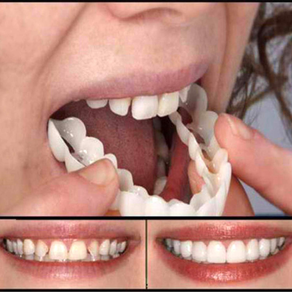 FairytaleMM Diente instantánea Sonrisa Perfecta Flex para blanquear los Dientes de la Sonrisa de la Cubierta Dientes Falsos