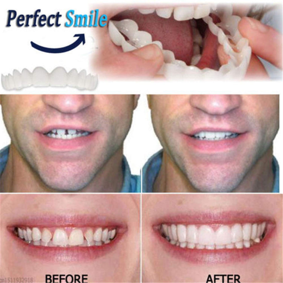 FairytaleMM Diente instantánea Sonrisa Perfecta Flex para blanquear los Dientes de la Sonrisa de la Cubierta Dientes Falsos