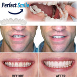 FairytaleMM Diente instantánea Sonrisa Perfecta Flex para blanquear los Dientes de la Sonrisa de la Cubierta Dientes Falsos