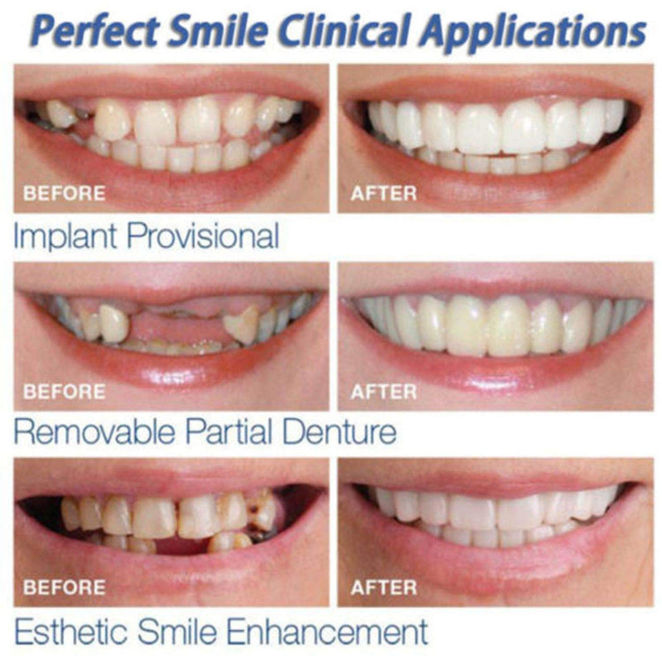 FairytaleMM Diente instantánea Sonrisa Perfecta Flex para blanquear los Dientes de la Sonrisa de la Cubierta Dientes Falsos
